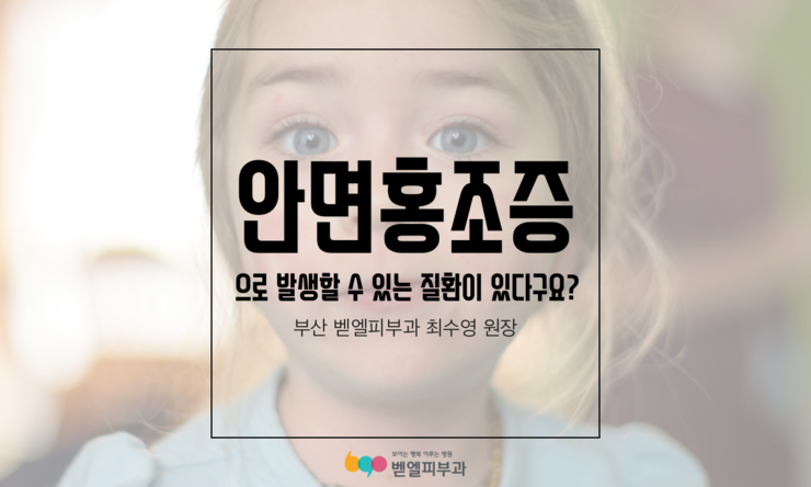 안면홍조증으로 발생할 수 있는 질환이 있다구요?