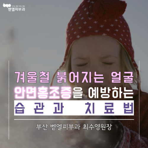 겨울철 붉어지는 얼굴. 안면홍조증을 예방하는 습관과 치료법